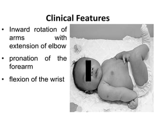 Nerve injuries ,fracture bone and dislocations in newborn part II | PPTX