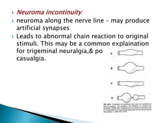  Neuroma incontinuity:
 neuroma along the nerve line – may produce
artificial synapses
 Leads to abnormal chain reaction to original
stimuli. This may be a common explaination
for trigeminal neuralgia,& post traumatic
casualgia.
 
