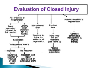 Evaluation of Closed Injury
 