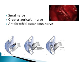  Sural nerve
 Greater auricular nerve
 Antebrachial cutaneous nerve
 