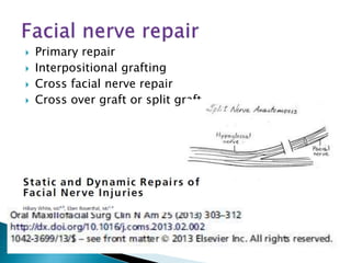  Primary repair
 Interpositional grafting
 Cross facial nerve repair
 Cross over graft or split graft
 