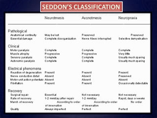 SEDDON’S CLASSIFICATION
 