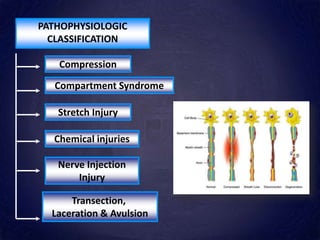 PATHOPHYSIOLOGIC
CLASSIFICATION
Compression
Compartment Syndrome
Transection,
Laceration & Avulsion
Stretch Injury
Chemical injuries
Nerve Injection
Injury
 