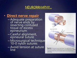 • Direct nerve repair
– Adequate preparation
of nerve ends by
resecting contused
tissue or excess
epineurium
– Careful alignment,
epineural suture
– Microsurgical technique
10-0 nylon sutures
– Avoid tension at suture
line
NEURORRHAPHY…
 