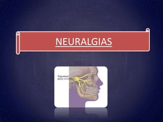 NEURALGIAS
 