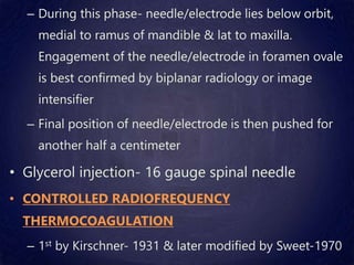 – During this phase- needle/electrode lies below orbit,
medial to ramus of mandible & lat to maxilla.
Engagement of the needle/electrode in foramen ovale
is best confirmed by biplanar radiology or image
intensifier
– Final position of needle/electrode is then pushed for
another half a centimeter
• Glycerol injection- 16 gauge spinal needle
• CONTROLLED RADIOFREQUENCY
THERMOCOAGULATION
– 1st by Kirschner- 1931 & later modified by Sweet-1970
 