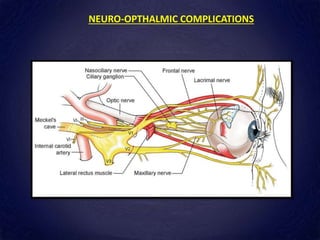 NEURO-OPTHALMIC COMPLICATIONS
 