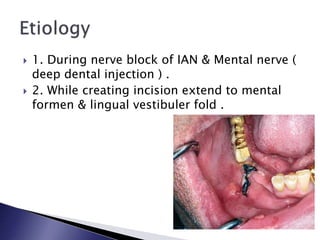  1. During nerve block of IAN & Mental nerve (
deep dental injection ) .
 2. While creating incision extend to mental
formen & lingual vestibuler fold .
 