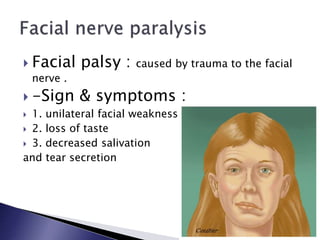  Facial palsy : caused by trauma to the facial
nerve .
 -Sign & symptoms :
 1. unilateral facial weakness
 2. loss of taste
 3. decreased salivation
and tear secretion
 