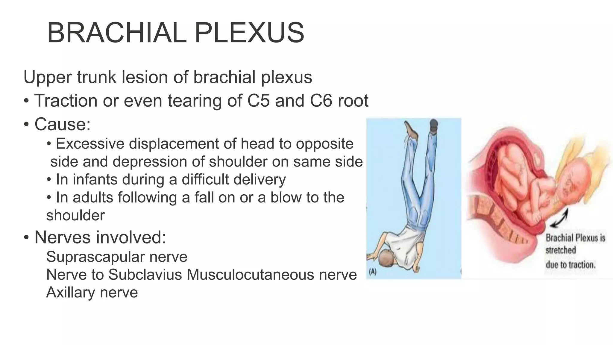 Nerve injury of upper limb | PPTX