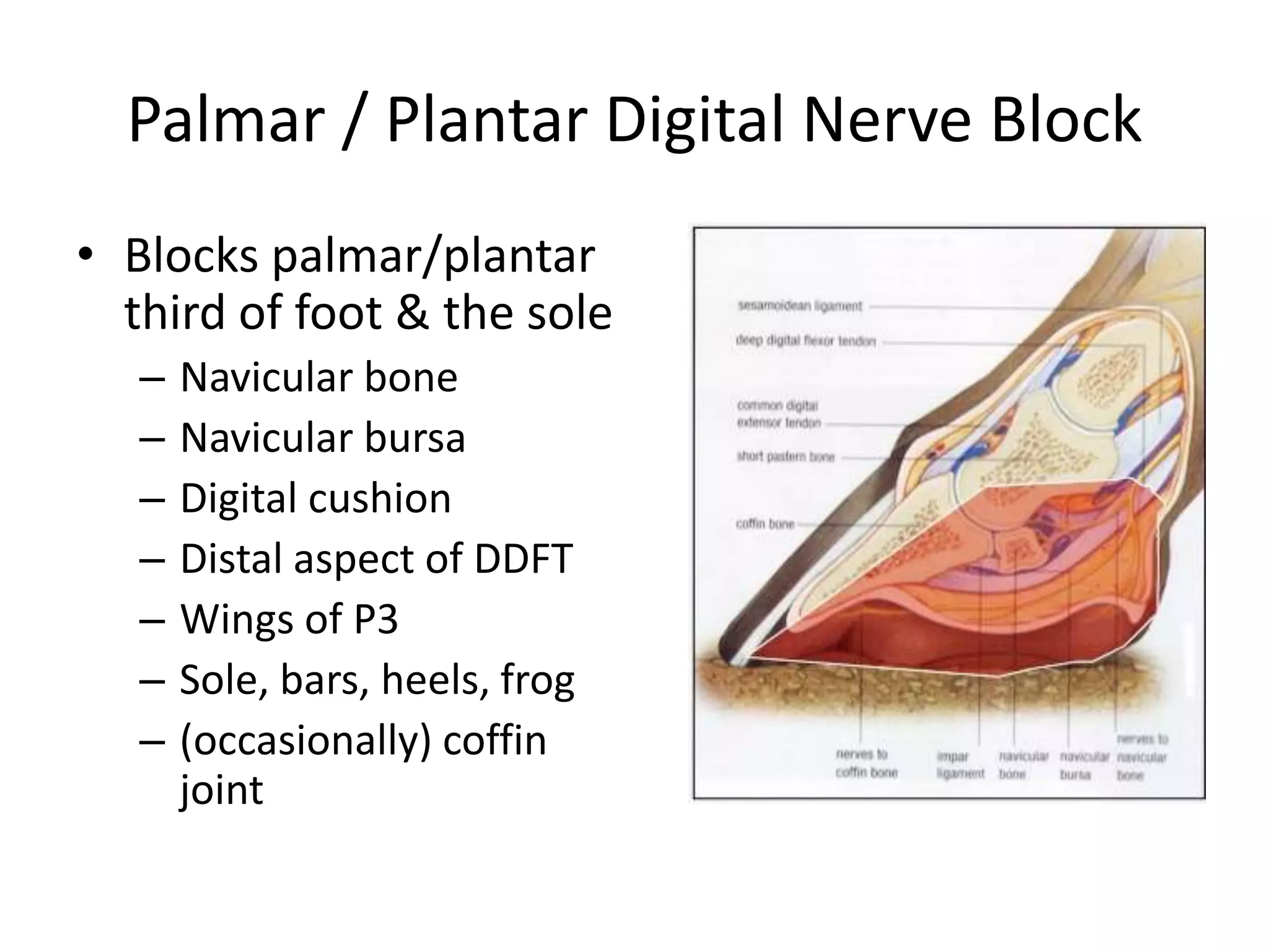 Palmar / Plantar Digital Nerve Block
• Blocks palmar/plantar
third of foot & the sole
– Navicular bone
– Navicular bursa
– Digital cushion
– Distal aspect of DDFT
– Wings of P3
– Sole, bars, heels, frog
– (occasionally) coffin
joint
 
