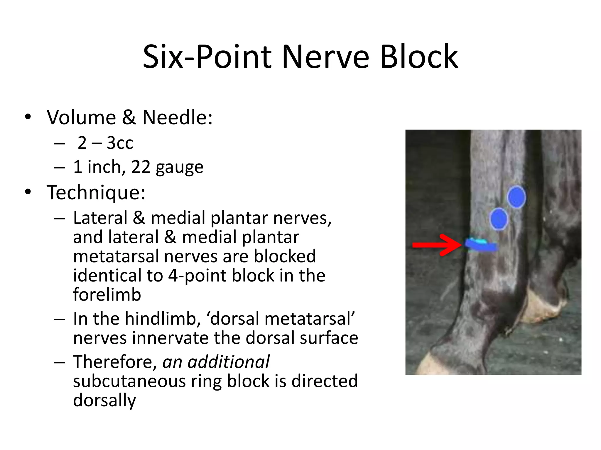 Six-Point Nerve Block
• Volume & Needle:
– 2 – 3cc
– 1 inch, 22 gauge
• Technique:
– Lateral & medial plantar nerves,
and lateral & medial plantar
metatarsal nerves are blocked
identical to 4-point block in the
forelimb
– In the hindlimb, ‘dorsal metatarsal’
nerves innervate the dorsal surface
– Therefore, an additional
subcutaneous ring block is directed
dorsally
 