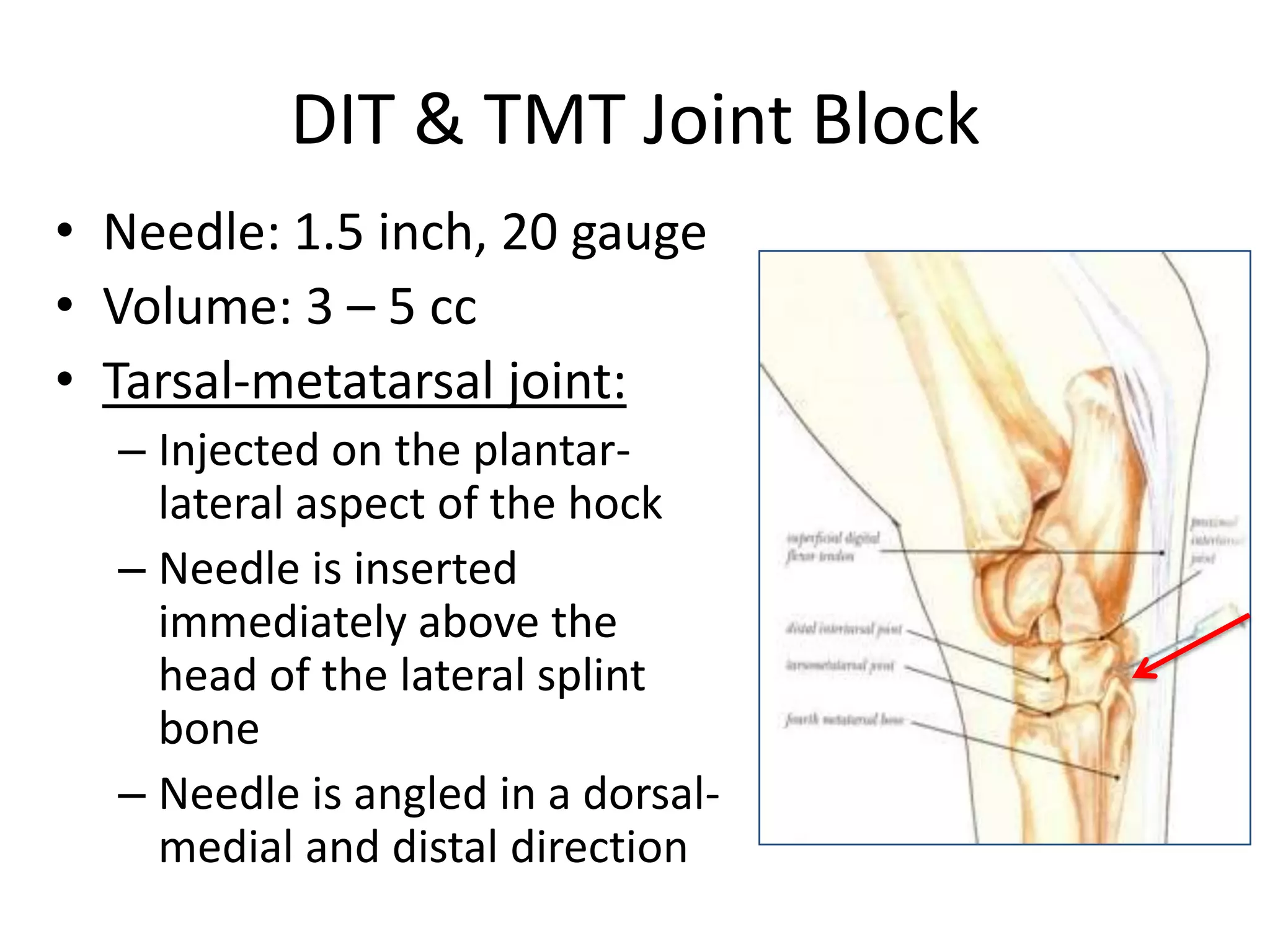 DIT & TMT Joint Block
• Needle: 1.5 inch, 20 gauge
• Volume: 3 – 5 cc
• Tarsal-metatarsal joint:
– Injected on the plantar-
lateral aspect of the hock
– Needle is inserted
immediately above the
head of the lateral splint
bone
– Needle is angled in a dorsal-
medial and distal direction
 