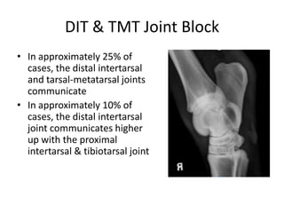 DIT & TMT Joint Block
• In approximately 25% of
cases, the distal intertarsal
and tarsal-metatarsal joints
communicate
• I...