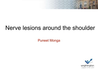 Nerve lesions around the shoulder
Puneet Monga
 
