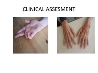 CLINICAL ASSESMENT
 