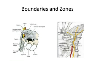 Boundaries and Zones
 