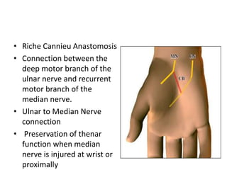 • Riche Cannieu Anastomosis
• Connection between the
deep motor branch of the
ulnar nerve and recurrent
motor branch of the
median nerve.
• Ulnar to Median Nerve
connection
• Preservation of thenar
function when median
nerve is injured at wrist or
proximally
 