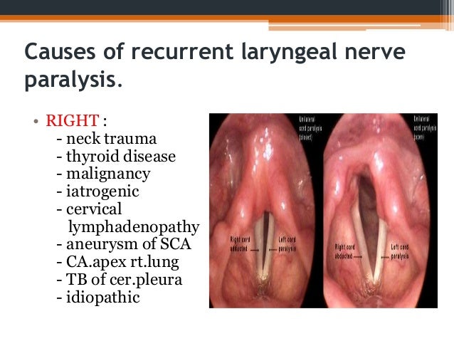 Nerve supply of larynx & laryngeal paralysis