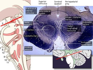 Nervio Oculomotor (Iii Par Craneal)