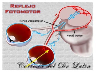Nervio Oculomotor (Iii Par Craneal)