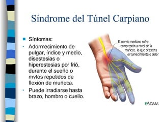Síndrome del Túnel Carpiano <ul><li>Síntomas:  </li></ul><ul><li>Adormecimiento de pulgar, índice y medio, disestesias o h...