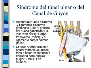 Síndrome del túnel ulnar o del Canal de Guyon <ul><li>Anatomía: Hueso pisiforme  y ligamento pisiforme ganchoso (ulnar), g...