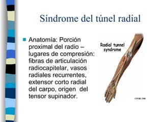 Síndrome del túnel radial <ul><li>Anatomía: Porción proximal del radio – lugares de compresión: fibras de articulación rad...