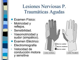 Lesiones Nerviosas P. Traumáticas Agudas <ul><li>Examen Físico: </li></ul><ul><li>Motricidad y reflejos. </li></ul><ul><li...