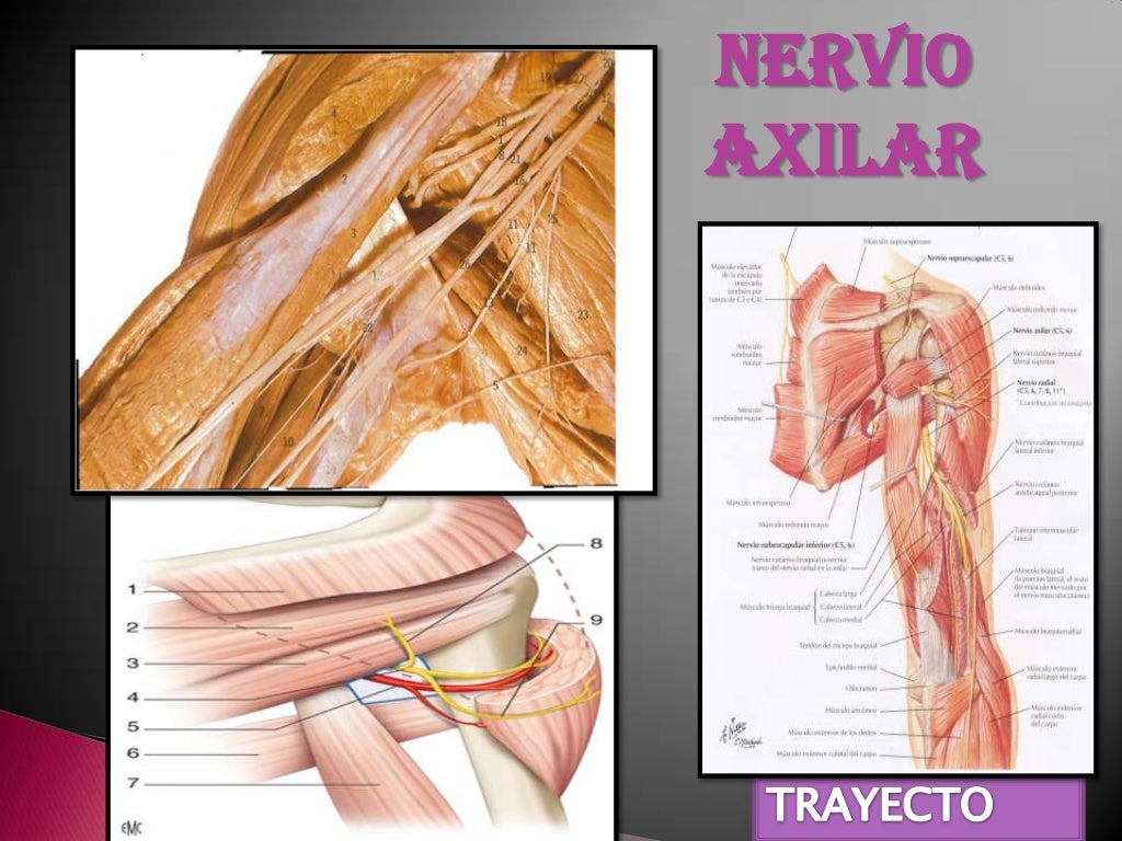 ¡Alarma! Inflamación del Nervio Axilar Nervio axilar inflamado