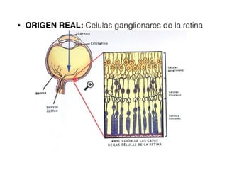 • ORIGEN REAL: Celulas ganglionares de la retina
 