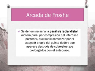 Arcada de Froshe

O Se denomina así a la parálisis radial distal,
  motora pura, por compresión del interóseo
    posterior, que suele comenzar por el
    extensor propio del quinto dedo y que
     aparece después de sobresfuerzos
        prolongados con el antebrazo.
 