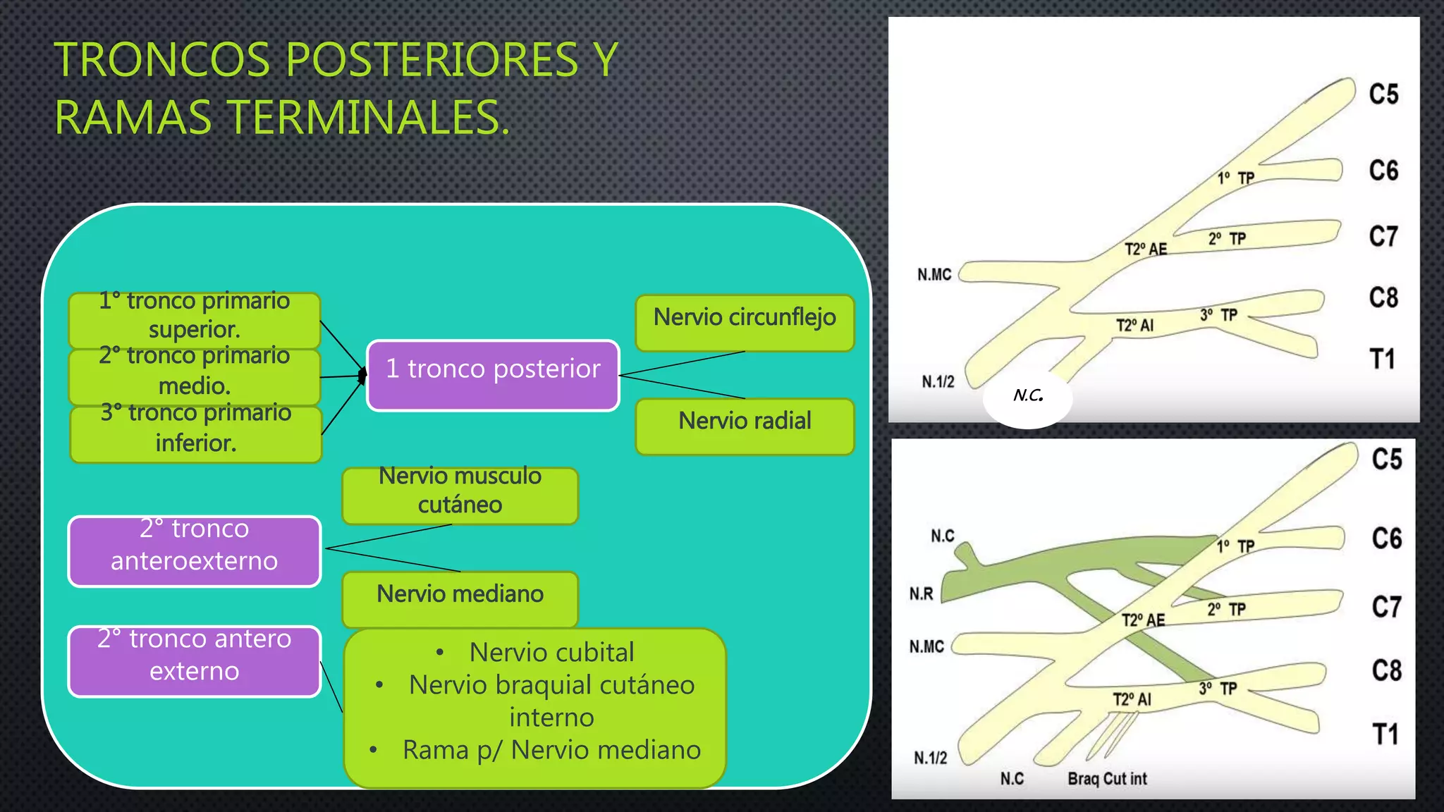 TRONCOS POSTERIORES Y
RAMAS TERMINALES.
1° tronco primario
superior.
2° tronco primario
medio.
3° tronco primario
inferior.
1 tronco posterior
Nervio circunflejo
Nervio radial
2° tronco
anteroexterno
2° tronco antero
externo
Nervio musculo
cutáneo
Nervio mediano
• Nervio cubital
• Nervio braquial cutáneo
interno
• Rama p/ Nervio mediano
N.C.
 