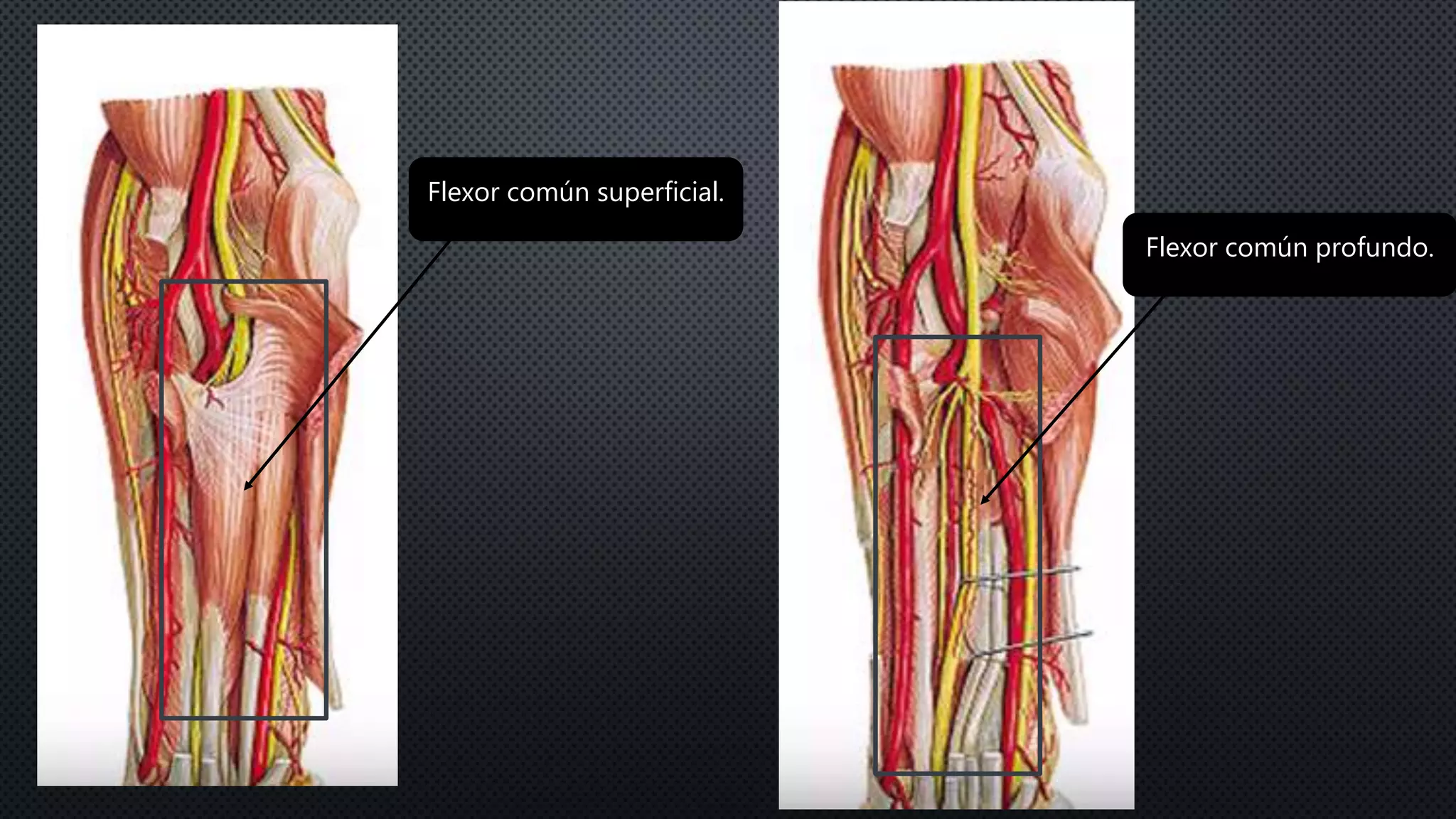 Flexor común superficial.
Flexor común profundo.
 