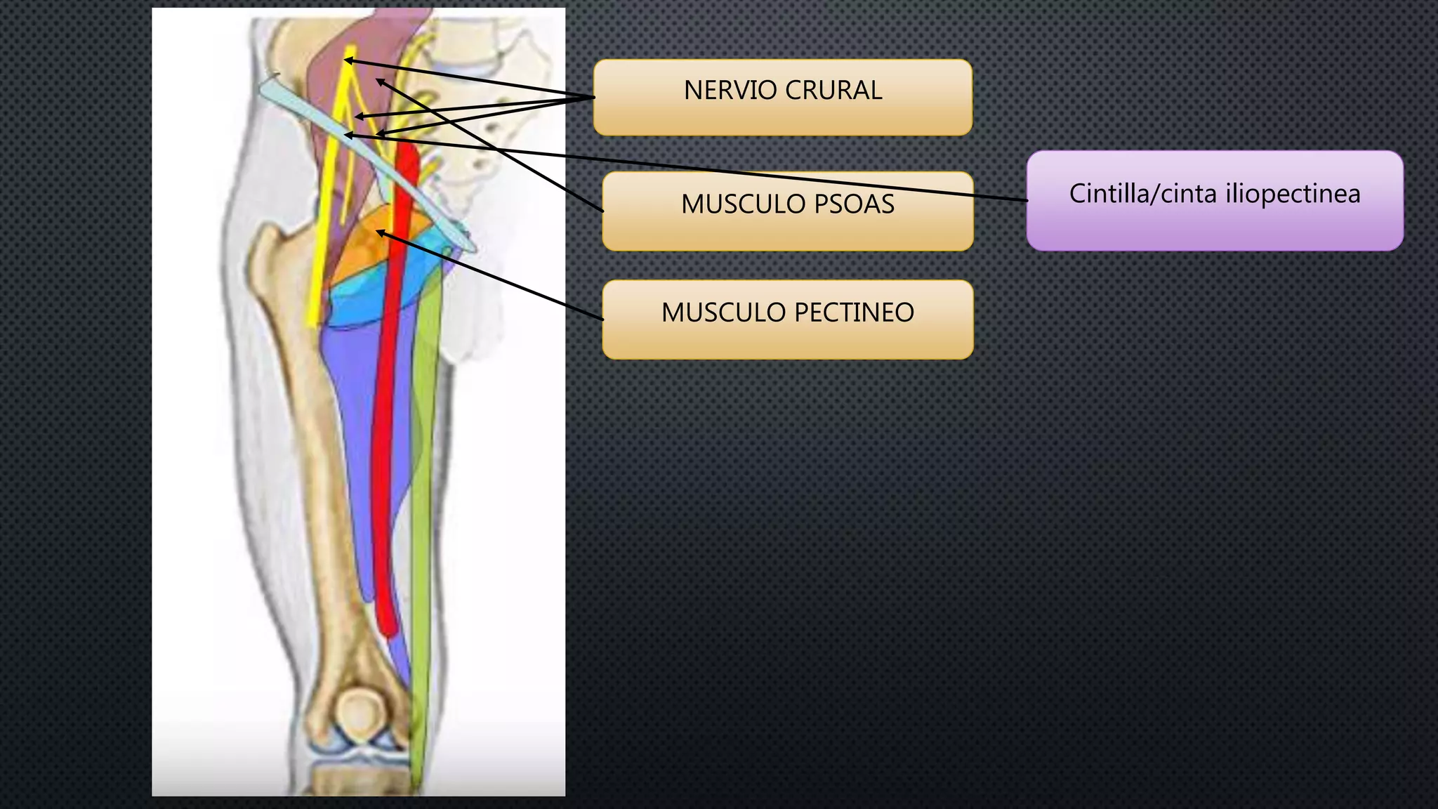 NERVIO CRURAL
MUSCULO PSOAS
MUSCULO PECTINEO
Cintilla/cinta iliopectinea
 