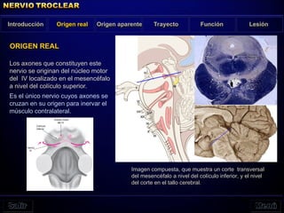 Los axones que constituyen este
nervio se originan del núcleo motor
del IV localizado en el mesencéfalo
a nivel del colículo superior.
Es el único nervio cuyos axones se
cruzan en su origen para inervar el
músculo contralateral.
Introducción Origen real
ORIGEN REAL
Origen aparente Trayecto Función Lesión
Imagen compuesta, que muestra un corte transversal
del mesencéfalo a nivel del colículo inferior, y el nivel
del corte en el tallo cerebral.
 
