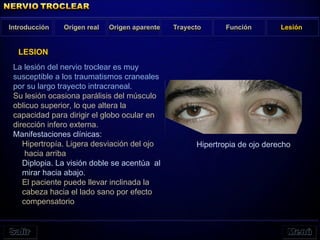 La lesión del nervio troclear es muy
susceptible a los traumatismos craneales
por su largo trayecto intracraneal.
Su lesión ocasiona parálisis del músculo
oblicuo superior, lo que altera la
capacidad para dirigir el globo ocular en
dirección infero externa.
Manifestaciones clínicas:
Hipertropía. Ligera desviación del ojo
hacia arriba
Diplopia. La visión doble se acentúa al
mirar hacia abajo.
El paciente puede llevar inclinada la
cabeza hacia el lado sano por efecto
compensatorio
Introducción Origen real Origen aparente Función Lesión
LESION
Trayecto
Hipertropia de ojo derecho
 