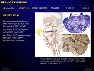 Los axones que constituyen
este nervio son de dos tipos
funcionales: ASG y EVE.
Las fibras ASG se originan
del ganglio trigeminal.
Las fibras EVE se originan en
el núcleo motor del V
localizado en el puente.
ORIGEN REAL
Imagen compuesta, que muestra un corte transversal
del puente a nivel del origen del nervio V, y el nivel del
corte en el tallo cerebral.
Introducción Origen real Origen aparente Trayecto Función Lesión
 