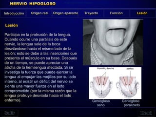 Participa en la protrusión de la lengua.
Cuando ocurre una parálisis de este
nervio, la lengua sale de la boca
desviándose hacia el mismo lado de la
lesión; esto se debe a las inserciones que
presenta el músculo en su base. Después
de un tiempo, se puede apreciar una
atrofia de la hemilengua afectada. Si se
investiga la fuerza que puede ejercer la
lengua al empujar las mejillas por su lado
interno, al existir un déficit del nervio se
siente una mayor fuerza en el lado
comprometido (por la misma razón que la
lengua protruye desviada hacia el lado
enfermo).
Introducción Origen real Origen aparente Trayecto Función Lesión
Lesión
Origin and Central Course
Geniogloso
sano
Geniogloso
paralizado
 
