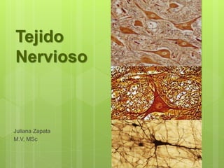 Tejido
Nervioso
Juliana Zapata
M.V, MSc
 