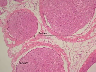 Epineuro Perineuro