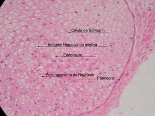 Perineuro Célula de Schwann Prolongamento do Neurônio Endoneuro Imagem Negativa da mielina