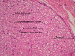 Perineuro Célula de Schwann Prolongamento do Neurônio Endoneuro Imagem Negativa da Mielina