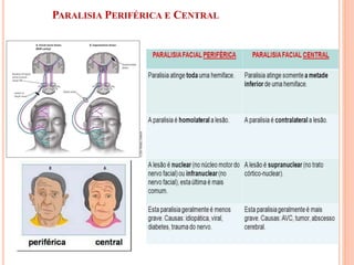 PARALISIA PERIFÉRICA E CENTRAL 
 
