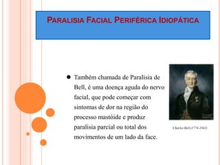 PARALISIA FACIAL PERIFÉRICA IDIOPÁTICA 
 Também chamada de Paralisia de 
Bell, é uma doença aguda do nervo 
facial, que pode começar com 
sintomas de dor na região do 
processo mastóide e produz 
paralisia parcial ou total dos 
movimentos de um lado da face. 
Charles Bell (1774-1842) 
 