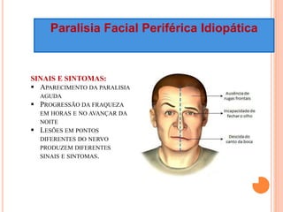 Paralisia Facial Periférica Idiopática 
SINAIS E SINTOMAS: 
 APARECIMENTO DA PARALISIA 
AGUDA 
 PROGRESSÃO DA FRAQUEZA 
EM HORAS E NO AVANÇAR DA 
NOITE 
 LESÕES EM PONTOS 
DIFERENTES DO NERVO 
PRODUZEM DIFERENTES 
SINAIS E SINTOMAS. 
 