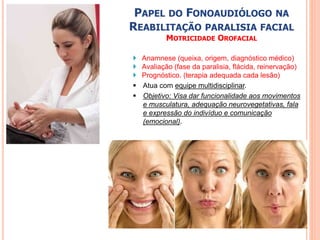 PAPEL DO FONOAUDIÓLOGO NA 
REABILITAÇÃO PARALISIA FACIAL 
MOTRICIDADE OROFACIAL 
 Anamnese (queixa, origem, diagnóstico médico) 
 Avaliação (fase da paralisia, flácida, reinervação) 
 Prognóstico. (terapia adequada cada lesão) 
 Atua com equipe multidisciplinar. 
 Objetivo: Visa dar funcionalidade aos movimentos 
e musculatura, adequação neurovegetativas, fala 
e expressão do indivíduo e comunicação 
(emocional). 
 