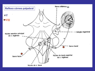 Reflexo córneo palpebral
V
VII
 