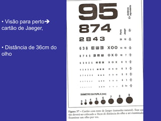 • Visão para perto
cartão de Jaeger,
• Distância de 36cm do
olho
 