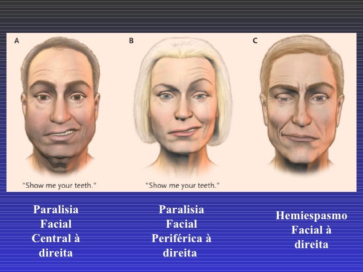 Nervos Cranianos Exame F sico Neurol gico Nervos Cranianos Exame F sico Neurol gico